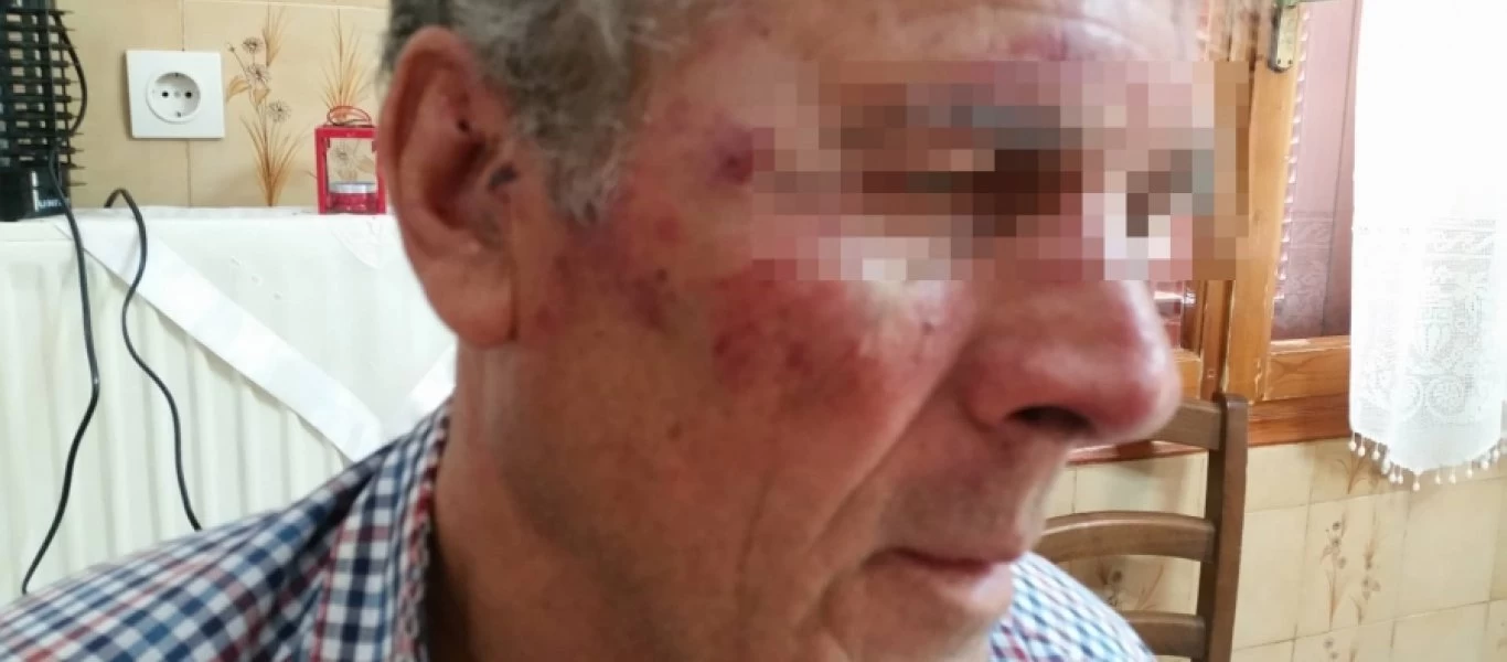 Σάμος: Τούρκοι ξυλοκόπησαν 73χρονο που άκουγε εκκλησιαστική μουσική! (φώτο)